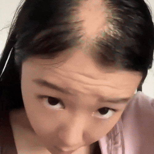 FEG Hair Growth Spray – Natural Hair Restoration, Anti-Hair Loss & Dandruff Control