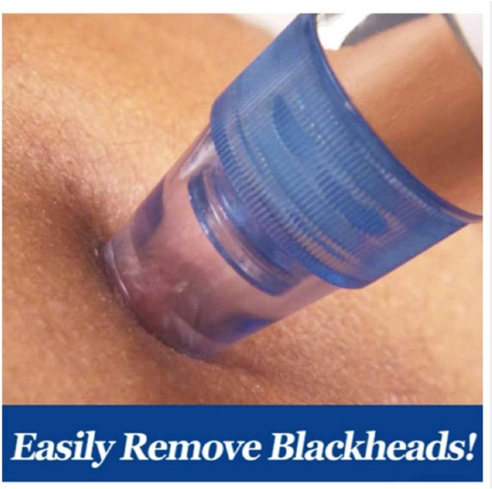 Rechargeable Blackhead Remover Pore Vacuum