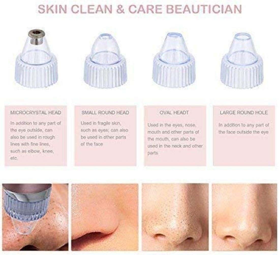 Rechargeable Blackhead Remover Pore Vacuum