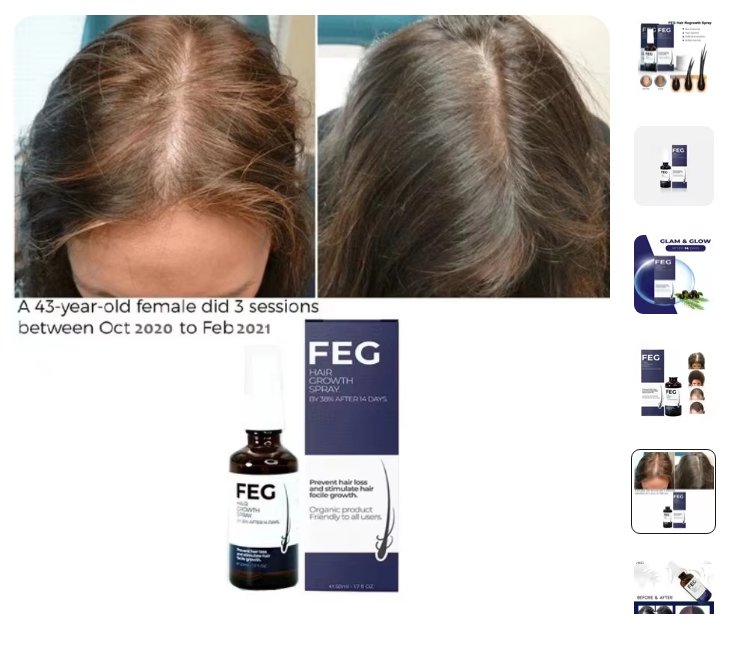 FEG Hair Growth Spray – Natural Hair Restoration, Anti-Hair Loss & Dandruff Control