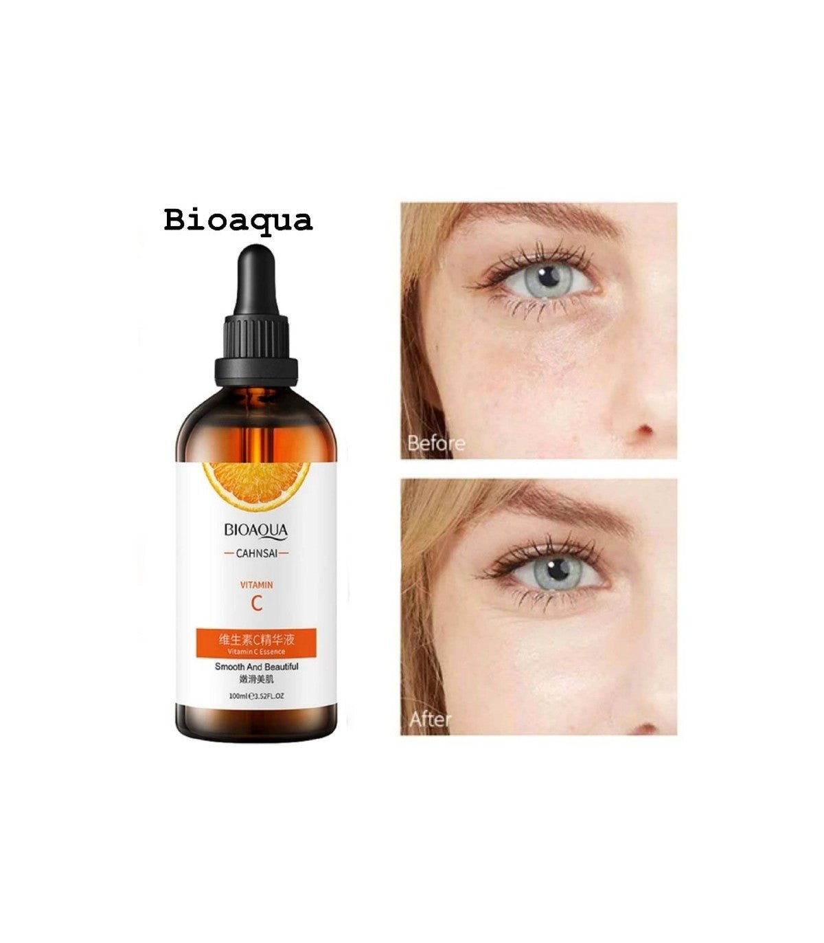 Vitamin C Serum (100ml) – Anti-Aging, Brightening & Hydrating Face Serum for Glowing Skin