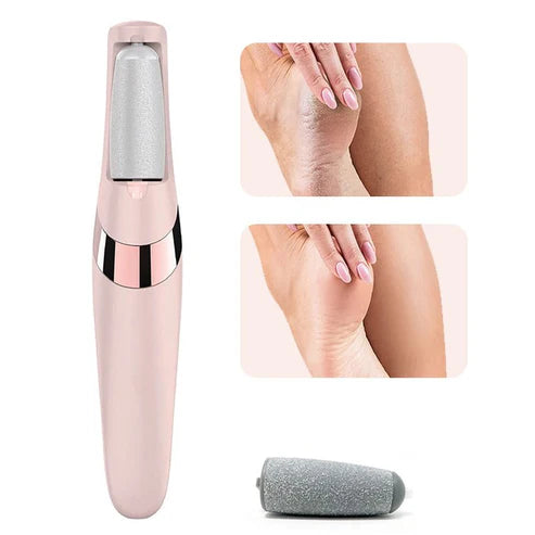 Electric Foot File Callus Remover – Rechargeable Pedicure Tool for Smooth Feet